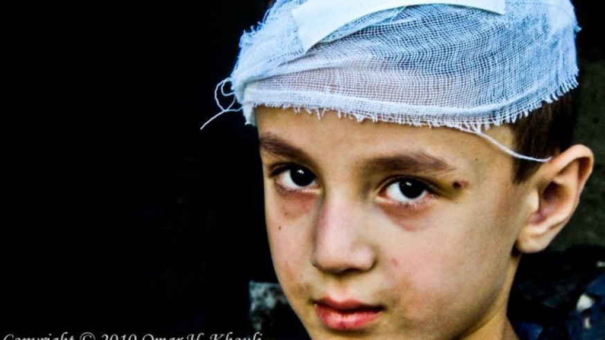 Wounded child – Photo – Omar Hikmat Khouli - 253814_186688404713088_8102965_n-684x492-874x492