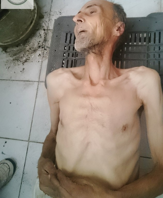 أحد ضحايا الجوع في مضايا، محمد عبد الكريم جواد، المصدر: صفحة المجلس الثوي المحلي في مضايا.