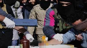 تنفيذ داعش حد السرقة بقطع يد السارق حسب الشريعة الإسلامية أمام مشفى الأمل في منبج، 25 كانون الثاني 2015، المصدر: موقع صوت وصورة.